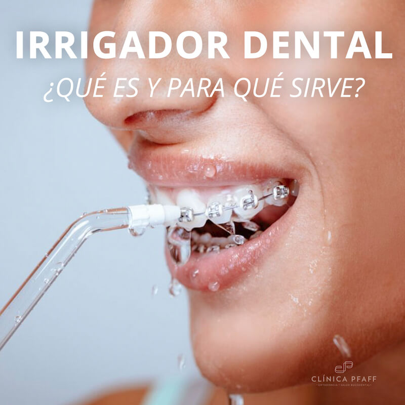 Mejor irrigador discount dental para ortodoncia