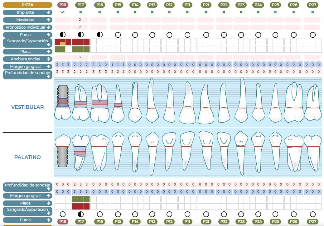 periodontograma-ejemplo periodontograma-ejemplo